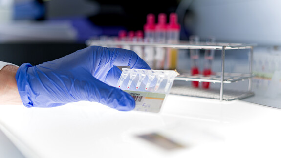 DRK-Blutspendedienst NSTOB bietet Antikörpertest auf das Coronavirus SARS-CoV-2 im Rahmen einer Blutspende an.