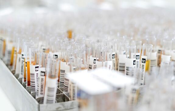 Labordiagnostik: viele Probenröhrchen